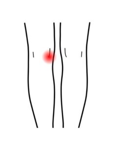 knees